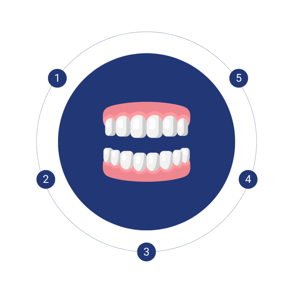 Dentures process