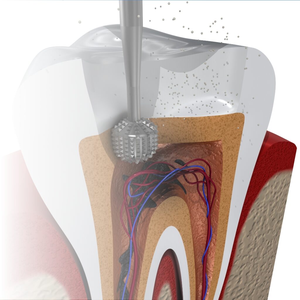 Endodontics