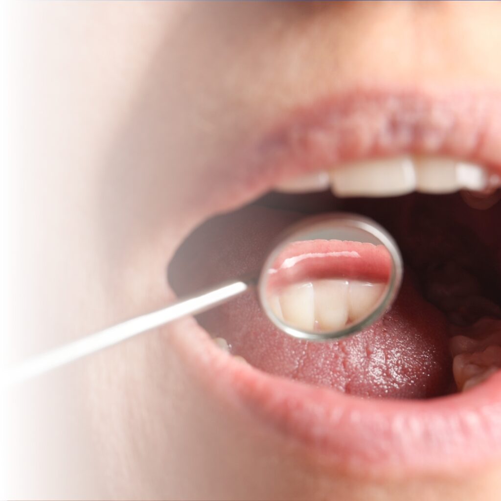 Dental Examination in midtown with magnifier