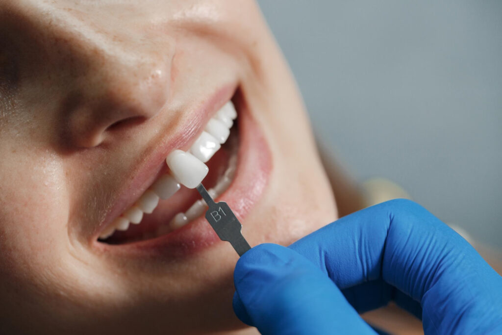 Dental Crown