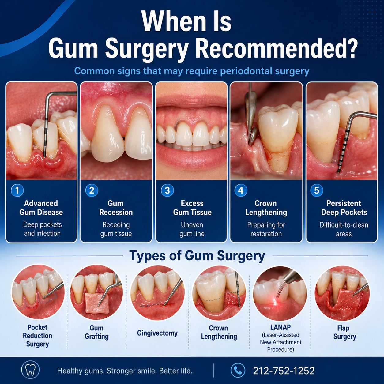 Gum surgery infographic showing advanced gum disease, gum recession, excess gum tissue, crown lengthening, persistent deep pockets, and common types of gum surgery