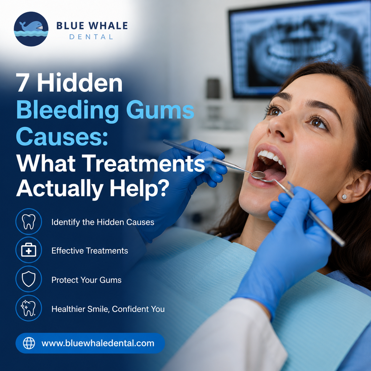 Bleeding gums causes explained during a dental examination showing common reasons for gum bleeding and effective treatment options
