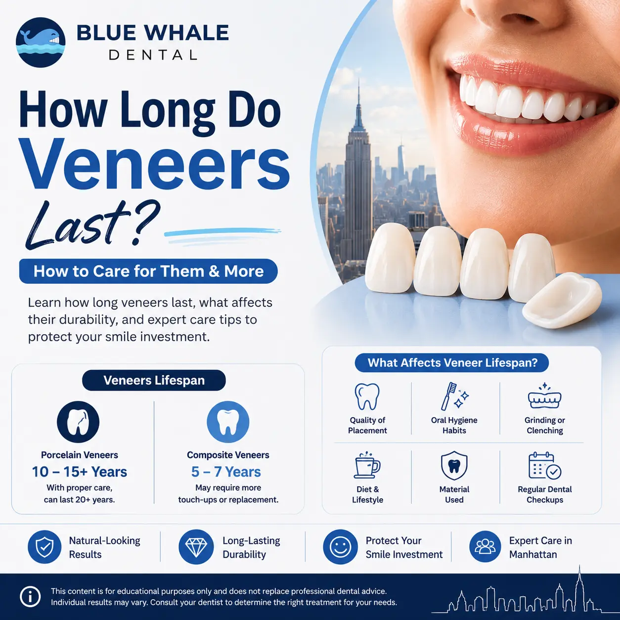 How long do veneers last? Dental veneers lifespan and care tips for protecting a long-lasting smile.